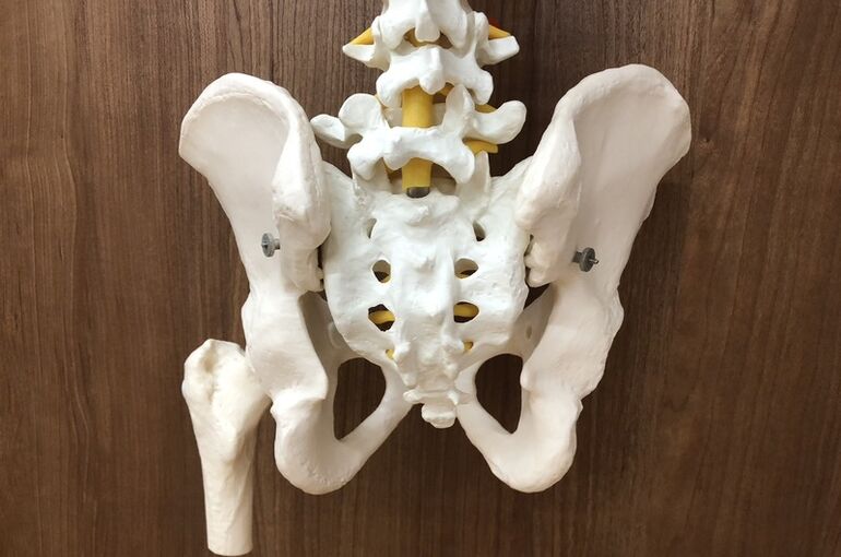 骨盤写真 (3)_800