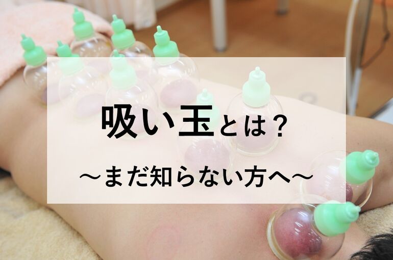 吸い玉とは？～まだ知らない方へ～