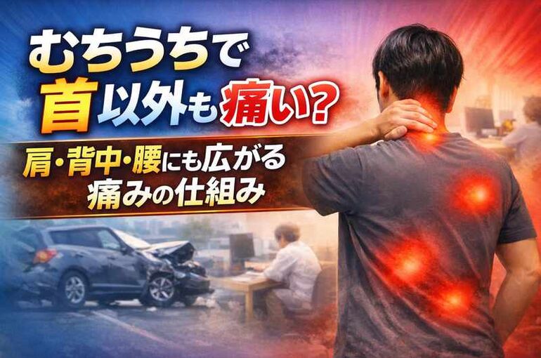 むちうち首以外